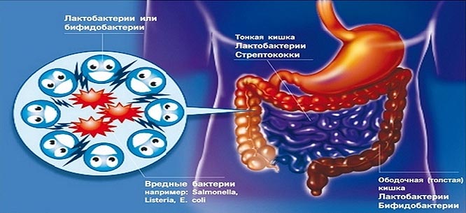 Какими лечить дисбактериоз