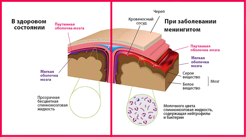 Мягкая оболочка. Мозговые оболочки гистология. Оболочки головного мозга гистология. Паутинная оболочка головного мозга гистология. Мягкая мозговая оболочка спинного мозга гистология.